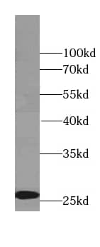 Western Blot: Rab3C Antibody - BSA Free [NBP3-46823] - Human brain tissue were subjected to SDS PAGE followed by western blot with (Rab3C antibody) at dilution of 1:300