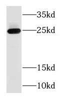 Western Blot: RAB3B Antibody - BSA Free [NBP3-46824] - Human brain tissue were subjected to SDS PAGE followed by western blot with (RAB3B antibody) at dilution of 1:800