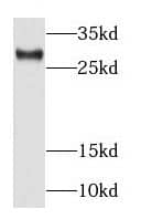 Western Blot RAB34 Antibody - BSA Free