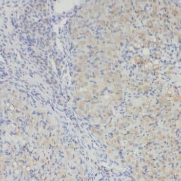 Immunohistochemistry RAB34 Antibody - BSA Free
