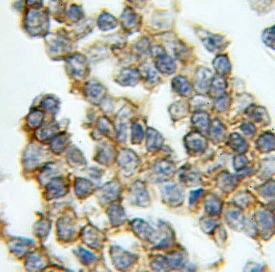 Immunohistochemistry RAB33A Antibody - BSA Free