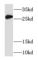 Western Blot RAB33A Antibody - BSA Free
