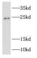 Western Blot: RAB2B Antibody - BSA Free [NBP3-46831] - Human brain tissue were subjected to SDS PAGE followed by western blot with (RAB2B antibody) at dilution of 1:800