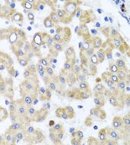 Immunohistochemistry: Rab24 Antibody - BSA Free [NBP3-46832] - Immunohistochemistry of paraffin-embedded human liver injury using (Rab24 antibody) at dilution of 1:100