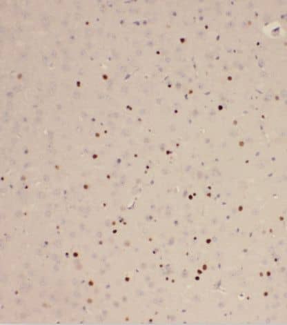 Immunohistochemistry Rab2 Antibody - BSA Free