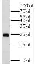 Western Blot Rab2 Antibody - BSA Free