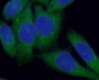 Immunocytochemistry/ Immunofluorescence RAB12 Antibody - BSA Free