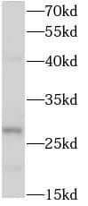 Western Blot RAB12 Antibody - BSA Free