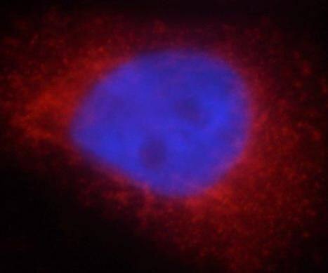Immunocytochemistry/ Immunofluorescence: PYCR2 Antibody - BSA Free [NBP3-46840] - Immunofluorescent analysis of HeLa cells using (PYCR2 antibody) at dilution of 1:50 and Rhodamine-Goat anti-Rabbit IgG