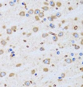 Immunohistochemistry: PTRH2 Antibody - BSA Free [NBP3-46846] - Immunohistochemistry of paraffin-embedded rat brain using (PTRH2 antibody) at dilution of 1:100