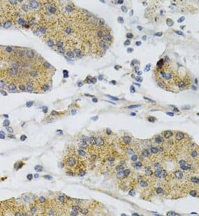 Immunohistochemistry: PTP alpha/PTPRA Antibody - BSA Free [NBP3-46848] - Immunohistochemistry of paraffin-embedded human stomach using (PTP alpha/PTPRA antibody) at dilution of 1:100
