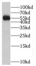 Western Blot PTPN4 Antibody - BSA Free