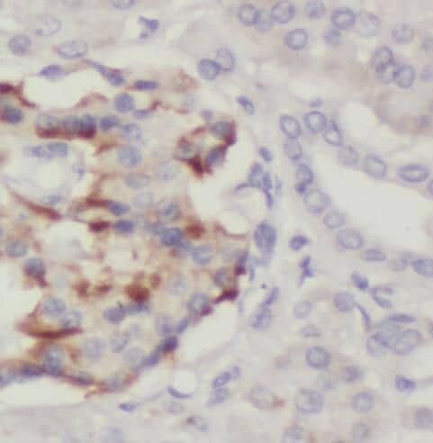 Immunohistochemistry PTPN4 Antibody - BSA Free