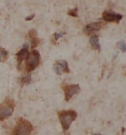 Immunohistochemistry: BDP1 Antibody - BSA Free [NBP3-46851] - Immunohistochemistry of paraffin-embedded human brain using (BDP1 antibody) at dilution of 1:100