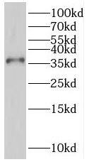 Western Blot PGR1 Antibody - BSA Free