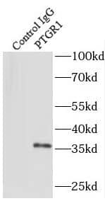 Immunoprecipitation: PGR1 Antibody - BSA Free [NBP3-46855] - IP Result of anti-PGR1 (IP:, 4ug; Detection: 1:500) with HepG2 cells lysate 3200ug.