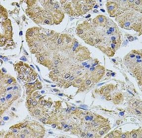 Immunohistochemistry: PTCD3 Antibody - BSA Free [NBP3-46857] - Immunohistochemistry of paraffin-embedded human stomach using ( PTCD3 Antibody) at dilution of 1:100
