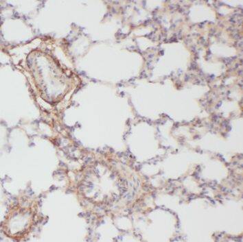 Immunohistochemistry: PAFR Antibody - BSA Free [NBP3-46858] - Immunohistochemistry of paraffin-embedded human lung using (PAFR antibody) at dilution of 1:50