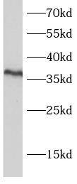 Western Blot: PSTPIP2 Antibody - BSA Free [NBP3-46859] - RAW 264.7 cells were subjected to SDS PAGE followed by western blot with (PSTPIP2 antibody) at dilution of 1:500