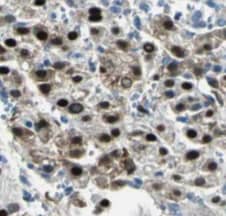 Immunohistochemistry PSME4 Antibody - BSA Free