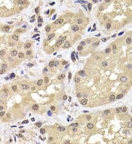 Immunohistochemistry: PSMD12 Antibody - BSA Free [NBP3-46863] - Immunohistochemistry of paraffin-embedded human kidney using (PSMD12 antibody) at dilution of 1:50