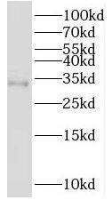 Western Blot: PSMB11 Antibody - BSA Free [NBP3-46864] - Jurkat cells were subjected to SDS PAGE followed by western blot with (PSMB11 antibody) at dilution of 1:300