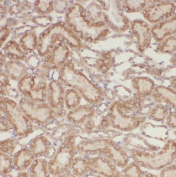 Immunohistochemistry PSMA8 Antibody - BSA Free