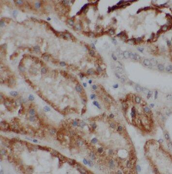 Immunohistochemistry: PSKH2 Antibody - BSA Free [NBP3-46867] - Immunohistochemistry of paraffin-embedded human kidney using (PSKH2 antibody) at dilution of 1:100