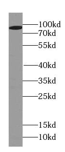 Western Blot: PSD2 Antibody - BSA Free [NBP3-46870] - Mouse brain tissue were subjected to SDS PAGE followed by western blot with (PSD2 antibody) at dilution of 1:1500