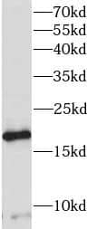 Western Blot: PRR13 Antibody - BSA Free [NBP3-46876] - MCF-7 cells were subjected to SDS PAGE followed by western blot with (PRR13 Antibody) at dilution of 1:300