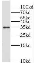 Western Blot: PRPS1L1 Antibody - BSA Free [NBP3-46878] - Human testis tissue?were subjected to SDS PAGE followed by western blot with (PRPS1L1 antibody) at dilution of 1:1000
