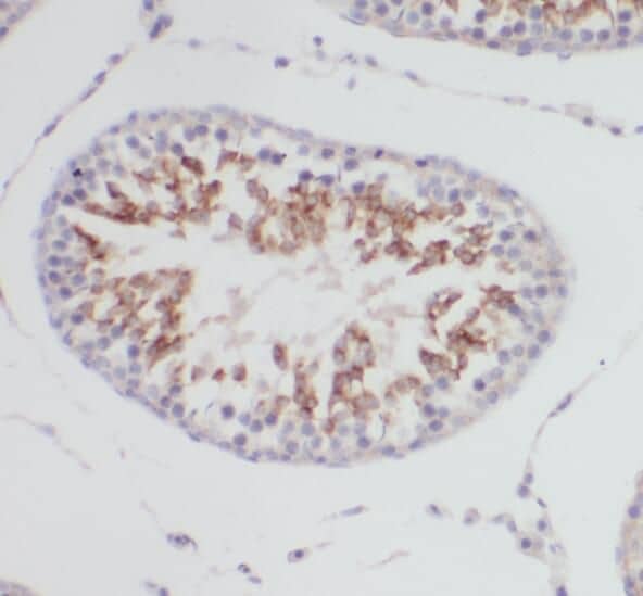 Immunohistochemistry PRPS1 Antibody - BSA Free
