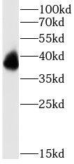 Western Blot Peripherin 2/PRPH2 Antibody - BSA Free
