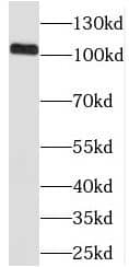 Western Blot: PRPF40B Antibody - BSA Free [NBP3-46882] - Y79 cells were subjected to SDS PAGE followed by western blot with (PRPF40B antibody) at dilution of 1:1000