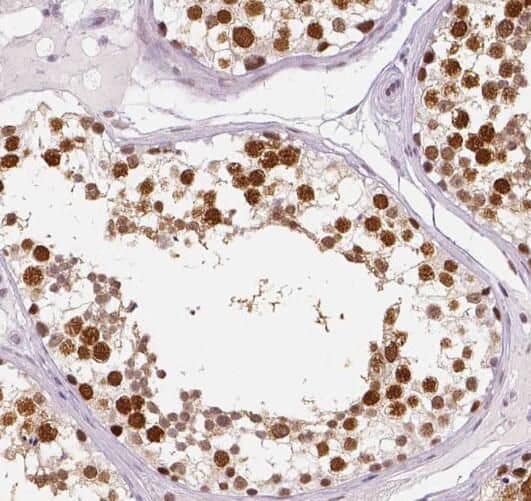 Immunohistochemistry: PRPF39 Antibody - BSA Free [NBP3-46883] - Immunohistochemistry of paraffin-embedded human testis tissue slide using (PRPF39 Antibody) at dilution of 1:100