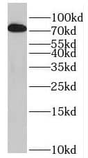 Western Blot: PRPF39 Antibody - BSA Free [NBP3-46883] - K-562 cells were subjected to SDS PAGE followed by western blot with (PRPF39 Antibody) at dilution of 1:1000