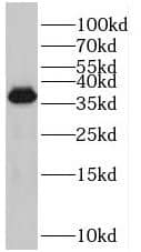 Western Blot: PRPF38A Antibody - BSA Free [NBP3-46884] - K-562 cells were subjected to SDS PAGE followed by western blot with ( PRPF38A Antibody) at dilution of 1:300