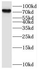 Western Blot: ProSAPiP1 Antibody - BSA Free [NBP3-46886] - Mouse brain tissue were subjected to SDS PAGE followed by western blot with ( ProSAPiP1 Antibody) at dilution of 1:600