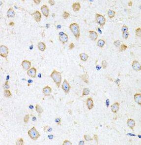 Immunohistochemistry: Prokineticin 2 Antibody - BSA Free [NBP3-46887] - Immunohistochemistry of paraffin-embedded mouse brain using ( Prokineticin 2 Antibody) at dilution of 1:100