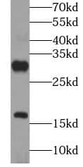 Western Blot: Gastrin-releasing Peptide/Bombesin/Neuromedin C Antibody - BSA Free [NBP3-46888] - PC-3 cells were subjected to SDS PAGE followed by western blot with (Gastrin-releasing Peptide/Bombesin/Neuromedin C antibody) at dilution of 1:1000