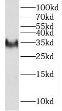 Western Blot: Doppel Antibody - BSA Free [NBP3-46889] - Human skeletal muscle tissue were subjected to SDS PAGE followed by western blot with (Doppel antibody) at dilution of 1:1000