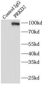 Immunoprecipitation: Protein Kinase D2 Antibody - BSA Free [NBP3-46893] - IP Result of anti-Protein Kinase D2 (IP:, 4ug; Detection: 1:500) with HeLa cells lysate 1200ug.