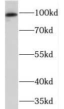 Western Blot: Protein Kinase D2 Antibody - BSA Free [NBP3-46893] - Human brain tissue were subjected to SDS PAGE followed by western blot with (Protein Kinase D2 antibody) at dilution of 1:500