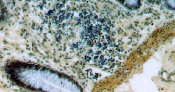 Immunohistochemistry: PRICKLE3 Antibody - BSA Free [NBP3-46897] - Immunohistochemistry of paraffin-embedded human colon using (PRICKLE3 antibody) at dilution of 1:50