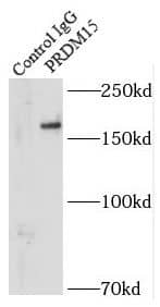 Immunoprecipitation: PRDM15 Antibody - BSA Free [NBP3-46901] - IP Result of anti-PRDM15 (IP:, 5ug; Detection: 1:500) with MCF-7 cells lysate 2500ug.