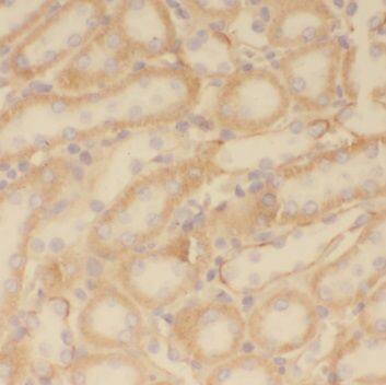 Immunohistochemistry: PPT1 Antibody - BSA Free [NBP3-46907] - Immunohistochemistry of paraffin-embedded human kindey using (PPT1 antibody) at dilution of 1:50