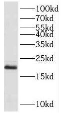 Western Blot PPP3R2 Antibody - BSA Free