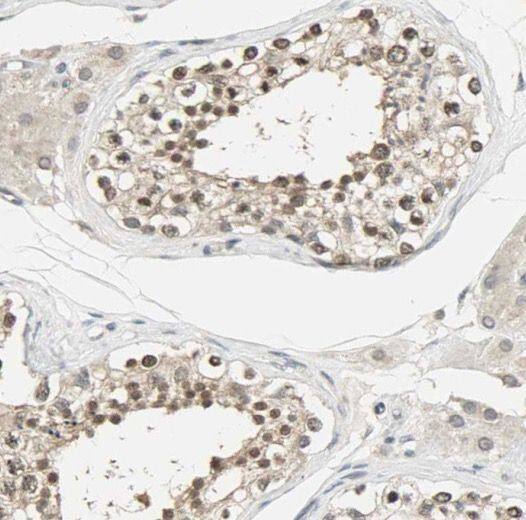 Immunohistochemistry PPP3R2 Antibody - BSA Free