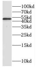 Western Blot: PPP2R2C Antibody - BSA Free [NBP3-46912] - HeLa cells were subjected to SDS PAGE followed by western blot with (PPP2R2C Antibody) at dilution of 1:1000