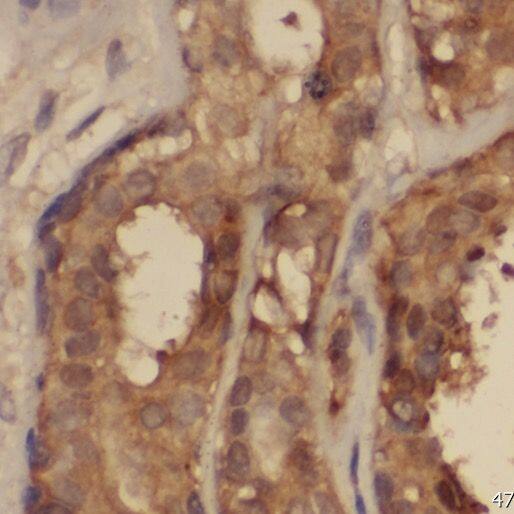 Immunohistochemistry PPP2R2C Antibody - BSA Free
